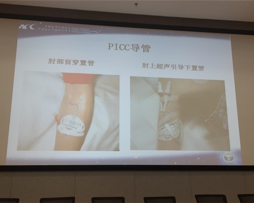 PICC置管视频教程，操作过程详解及注意事项指南